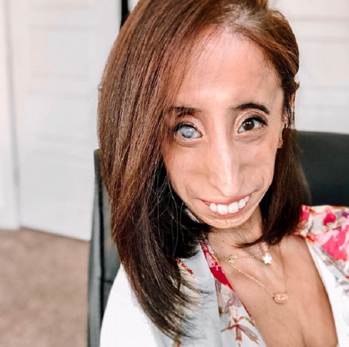 Lizzie Velasquez