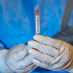 Ce este Hantavirusul, confirmat și în România. Cum se transmite și care sunt simptomele bolii care a ucis-o pe soția lui Gene Hackman: „Nu există vaccin, nici tratament țintit”