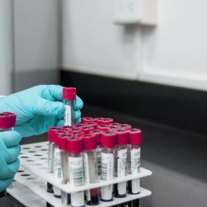Bărbatul de 25 de ani din Arad, testat pozitiv, are hantavirus. Institutul Cantacuzino: „Tulpina e asociată șoarecilor, nu se transmite de la om la om”