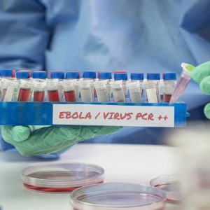 Ce este Ebola, cum se transmite, cât de mortal e virusul și ce tratamente există