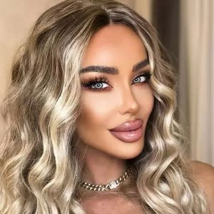 Bianca Drăgușanu și-a făcut operație de micșorare a urechilor: „Acum sunt mai mici și mai frumoase. Vreo 10 zile o să am freza asta cu banderolă”