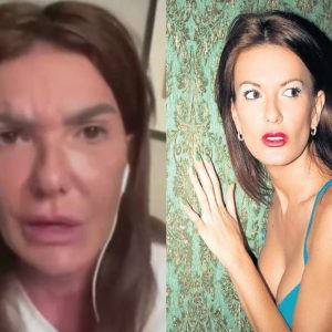 Fosta soție a lui Florin Cernat, supusă la 29 de intervenții după Aquafilling, procedura făcută și de Laurette și de Antonia: „Am un stimulator cardiac. Infecția m-ar omorî pe loc!”