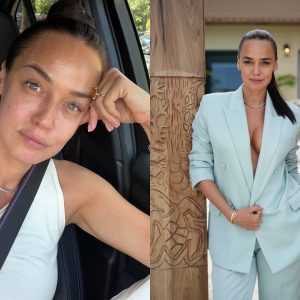 Andreea Raicu a început să își injecteze botox la 20 de ani, după ce o prietenă a convins-o: „Mi-am ‘înghețat’ fața total, ceea ce mi s-a părut îngrozitor. Dar așa făcea toată lumea în jurul meu”