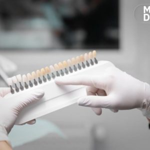 Cum pot tehnologiile disponibile la Mb Dental să reducă timpul petrecut la dentist