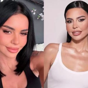 Andreea Popescu vrea să reia injecțiile pentru slăbit, la patru luni după ce le-a oprit: „Am reușit să mă mențin, nu știu cum. L-aș reîncepe, dar nu pentru slăbit”. Care este motivul