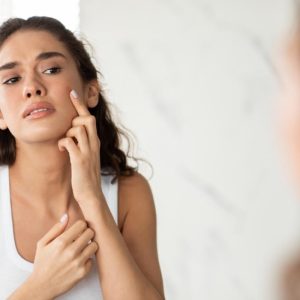 Tenul adolescentului și greșelile de îngrijire care pot agrava acneea